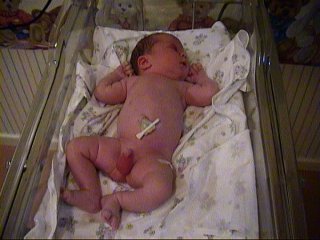 [ Alexander being checked upon]